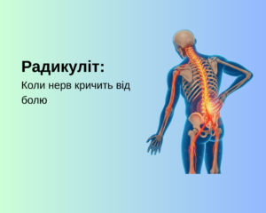 Радикуліт: Коли нерв кричить від болю