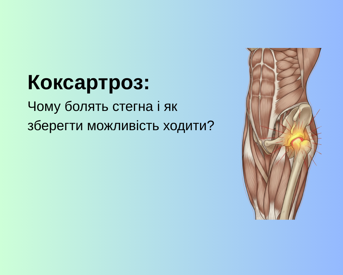 Коксартроз: Чому болять стегна і як зберегти можливість ходити