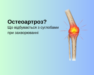 Що відбувається з суглобами при захворюванні Остеоартроз?