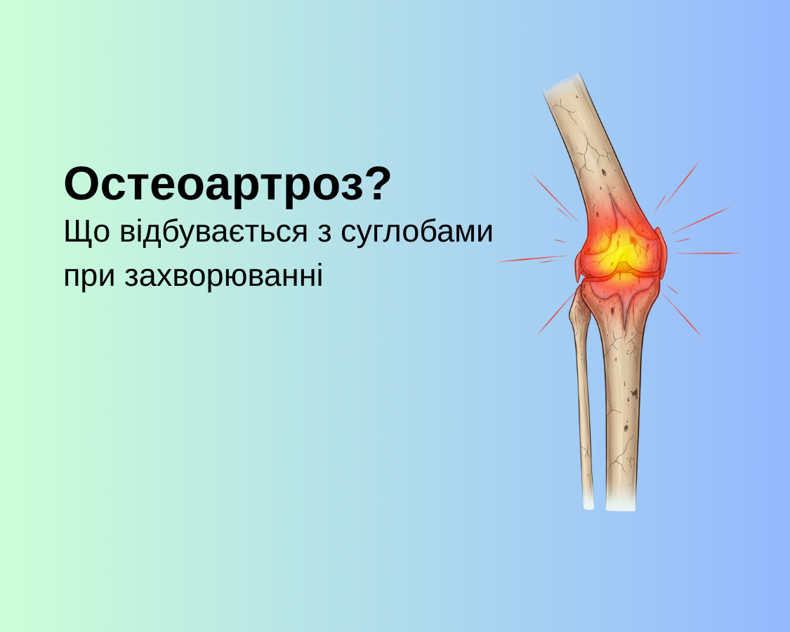 Що відбувається з суглобами при захворюванні Остеоартроз?