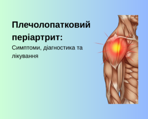 Плечолопатковий періартрит: Симптоми, діагностика та лікування