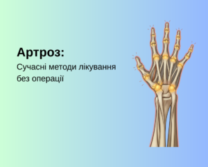 Артроз: Сучасні методи лікування без операції
