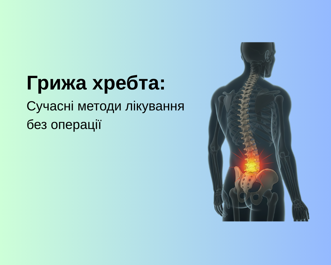 Грижа хребта: Сучасні методи лікування без операції