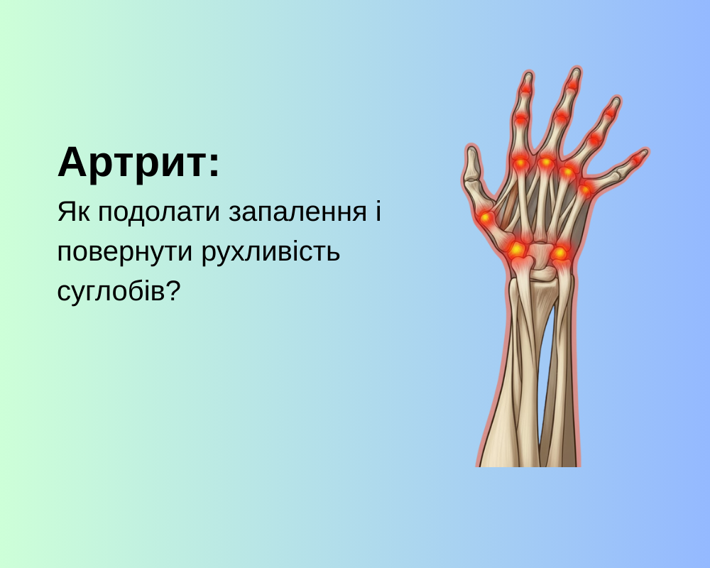 Артрит: Як подолати запалення і повернути рухливість суглобів?