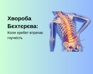 Хвороба Бєхтєрєва: Коли хребет втрачає гнучкість