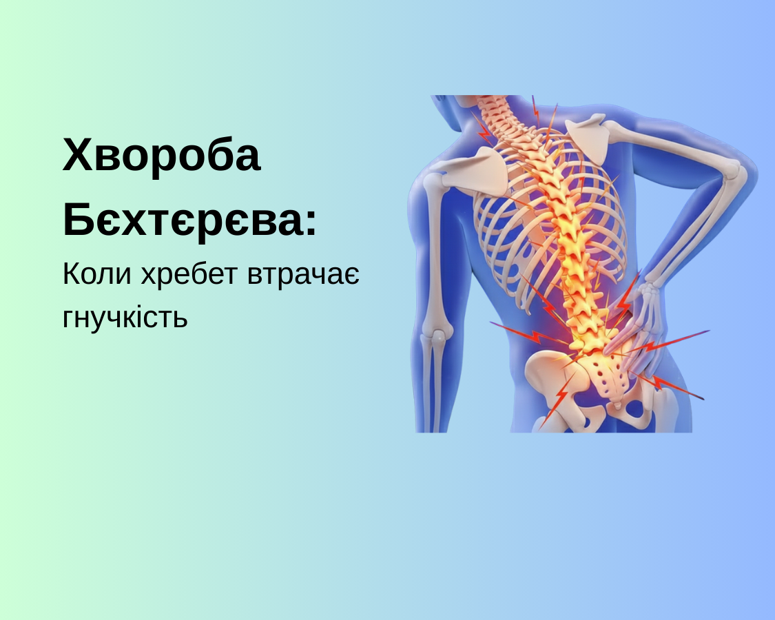 Хвороба Бєхтєрєва: Коли хребет втрачає гнучкість