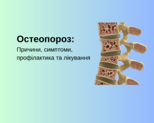 Остеопороз: Причини, симптоми, профілактика та лікування