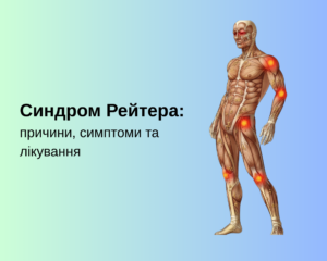 Синдром Рейтера: причини, симптоми та лікування